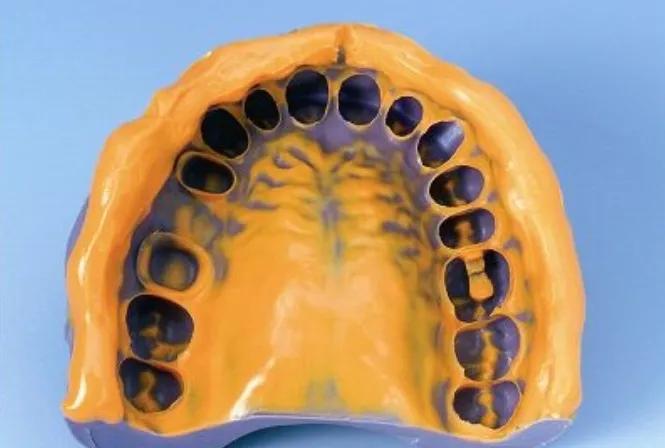 牙科一次性取模托盘,牙科托盘如何消毒