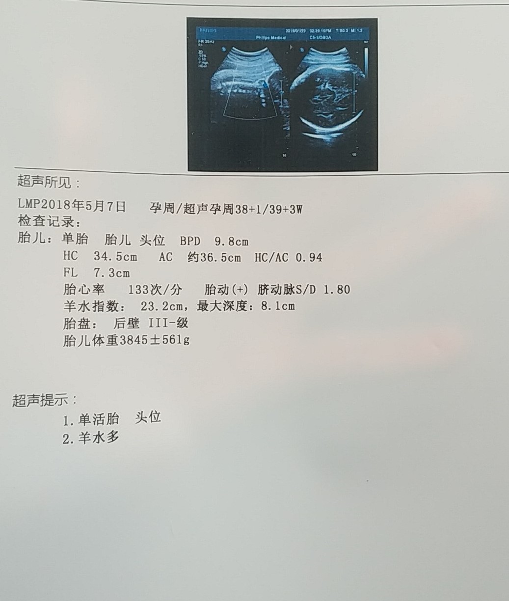 孕期做什么检查才能排除基因问题,孕期要做什么检查能确诊胎停