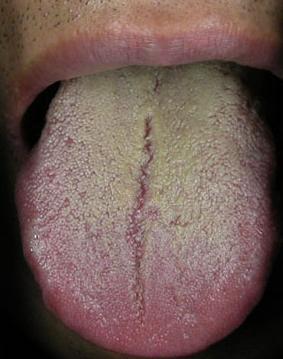 罗大伦讲中医健脾胃,罗大伦谈脾胃虚弱的调理