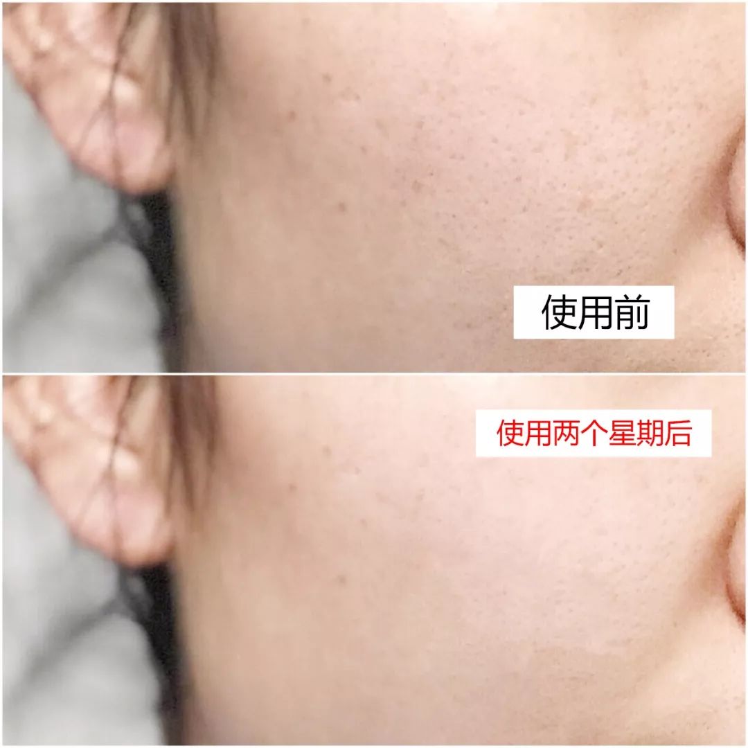 淡斑美白cp霜,美白淡斑cp推荐