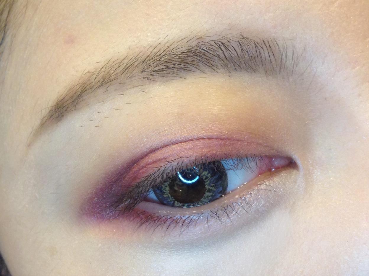 熬夜会引起眼睛肿吗,眼睛肿是怎么引起的