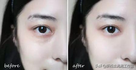 吴昕同款祛黄脸,吴昕眼袋