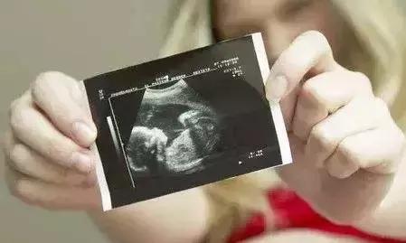 四维彩超电话预约后还需要排队吗,做四维彩超排队视频