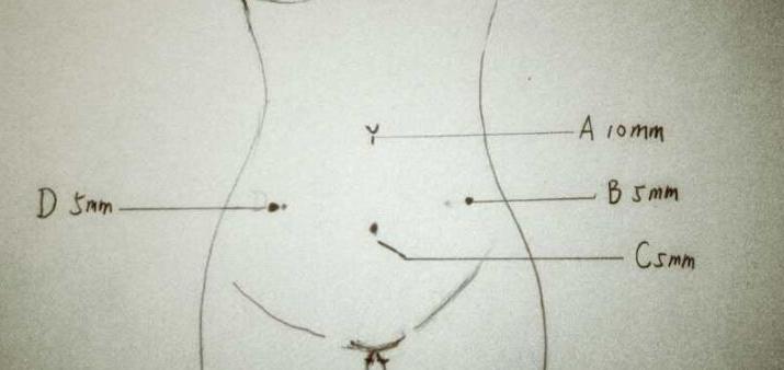 hpv感染和脚气有关吗,hpv感染和哪些肿瘤有关