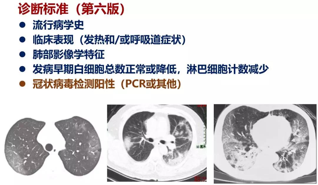 陈荣昌在哪个医院,陈荣昌广州呼吸疾病研究所所长