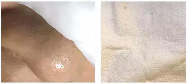 护肤太多的坏处有哪些呢,护肤越补越糟糕