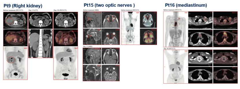 潘静主任,潘静医生怎么样
