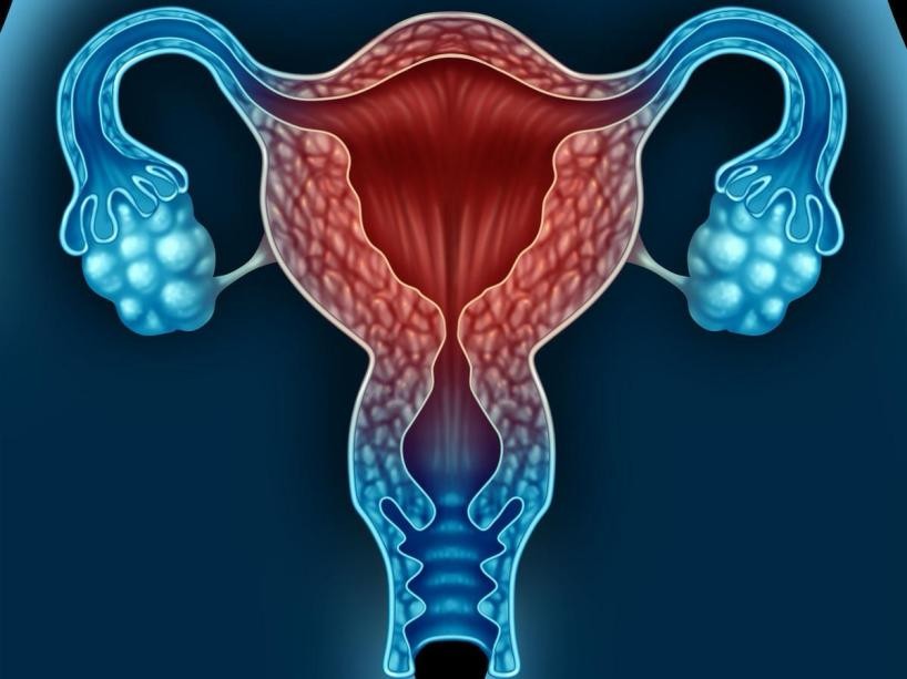 未婚23岁宫颈糜烂,女人没结婚怎么会宫颈糜烂