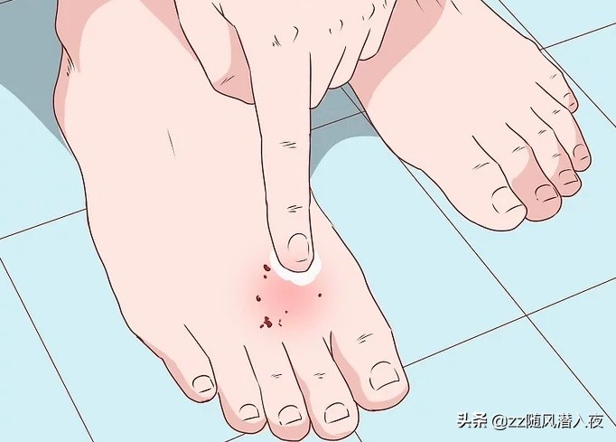 狗咬狗狗的伤口怎么处理,狗被狗咬的伤口肿了怎么办