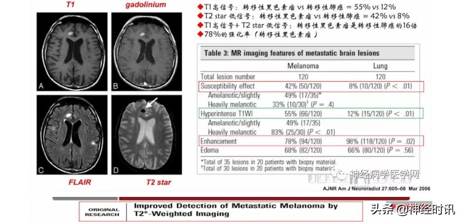 缺血性脑血管病出血评估,脑血管微出血怎么治疗