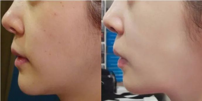 女孩专用补水面膜,女孩子专用面膜