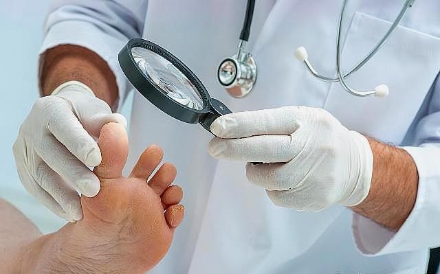 脚气为什么药会越抹越严重,脚气总是治不好是缺营养吗