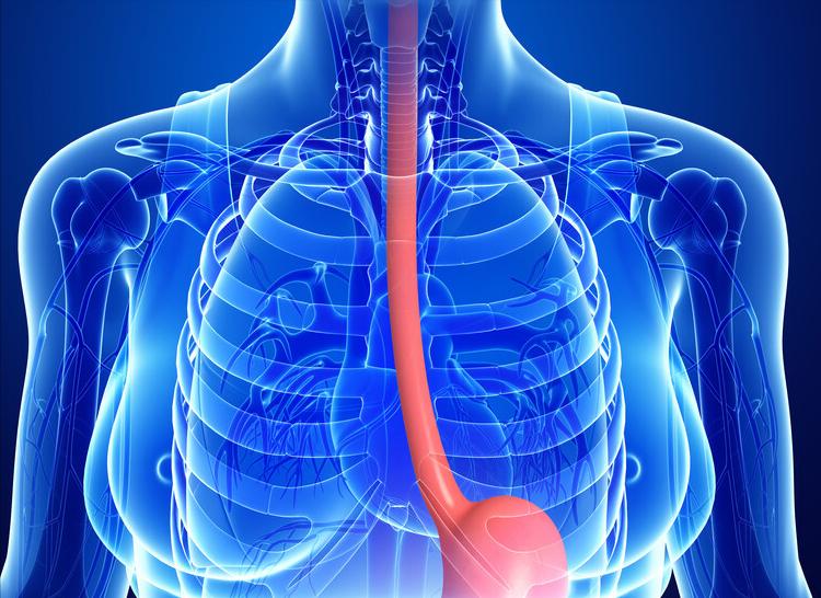 食管鳞癌放疗怎么防止食管瘘,食管鳞状细胞癌放疗并发症