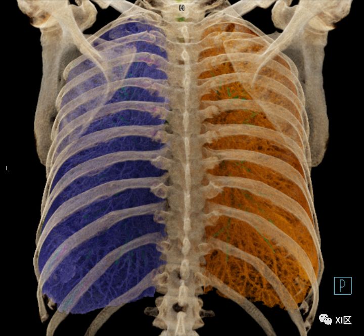 如此详细的肺部影像解剖，有点儿酷！