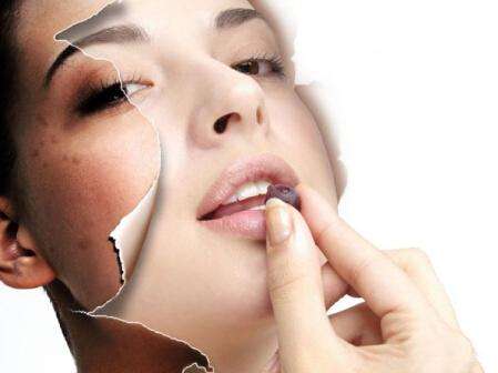 花了上万块祛斑有反弹的吗,激光祛斑反黑用什么产品能恢复好