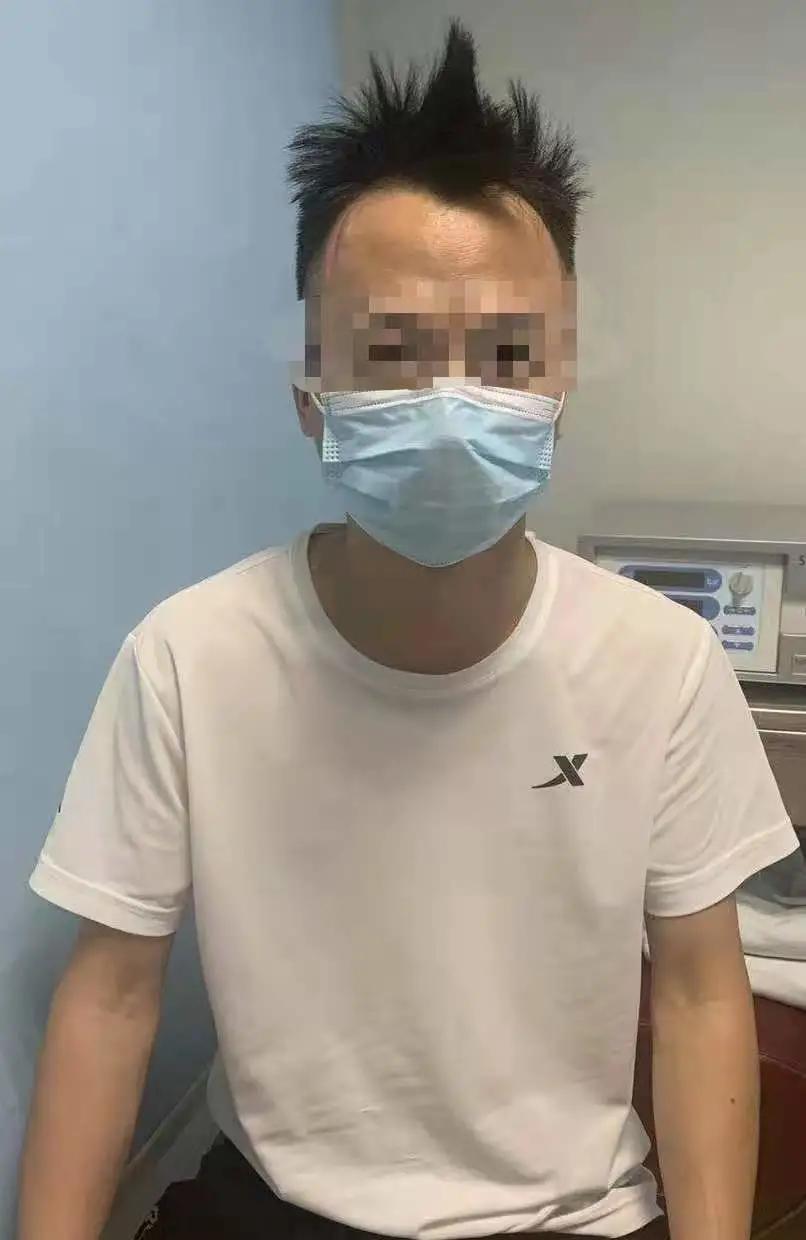 落枕了后颈痛一招搞定,筋膜枪治疗落枕的最快方法