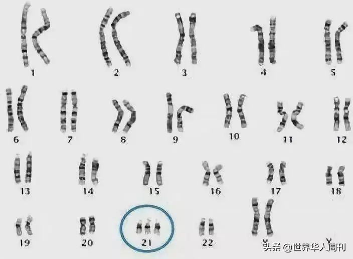 70岁生第一个孩子完整版,70岁生第一个孩子很丢人吗