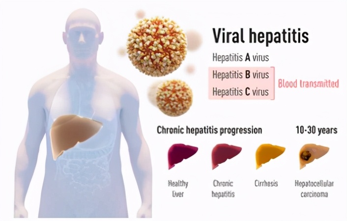 新冠病毒诺贝尔奖,丙肝研究获诺奖