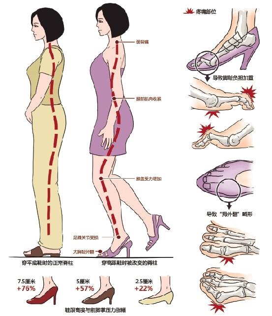 中老年女性为何比男性更容易腰腿疼痛？医生揭秘9大原因