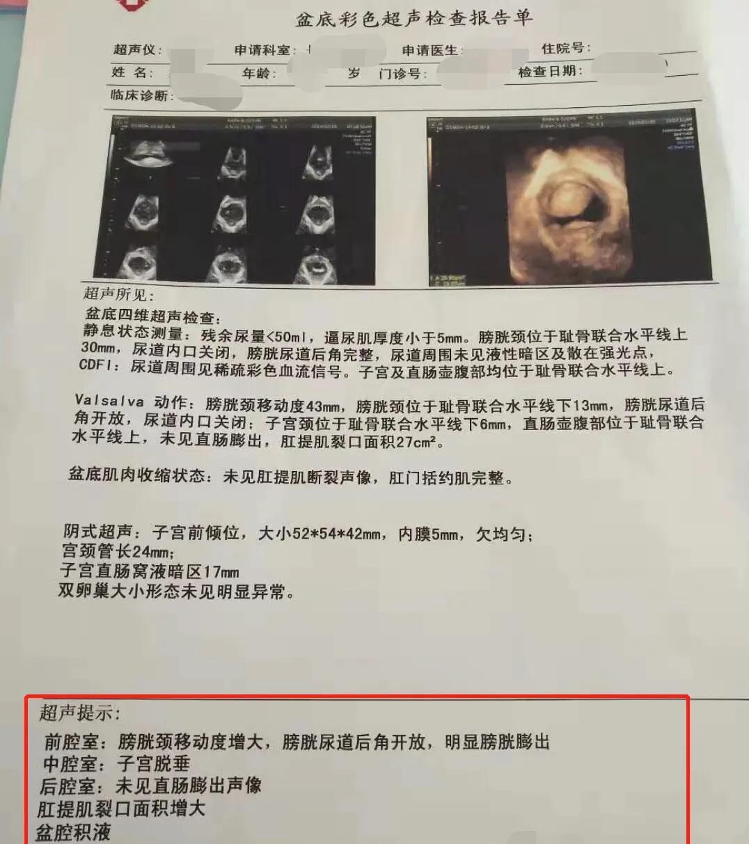 产后修复催乳有什么方法,产后修复催乳师怎么样