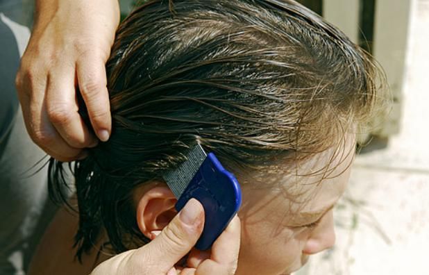 80年代人头上为什么有好多虱子,为什么90年代的人有虱子