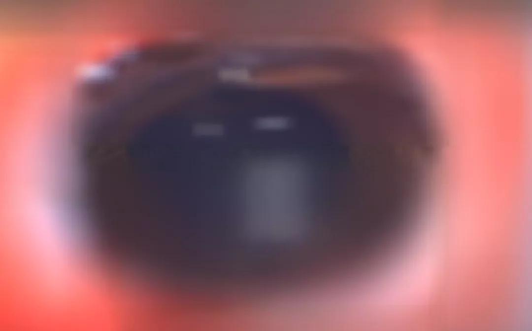 汽水瓶盖砸到眼睛,可乐瓶盖飞出去