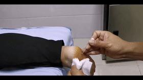 脚后跟痛是怎么回事是不是癌症,跟骨骨刺会引起脚后跟肿疼吗