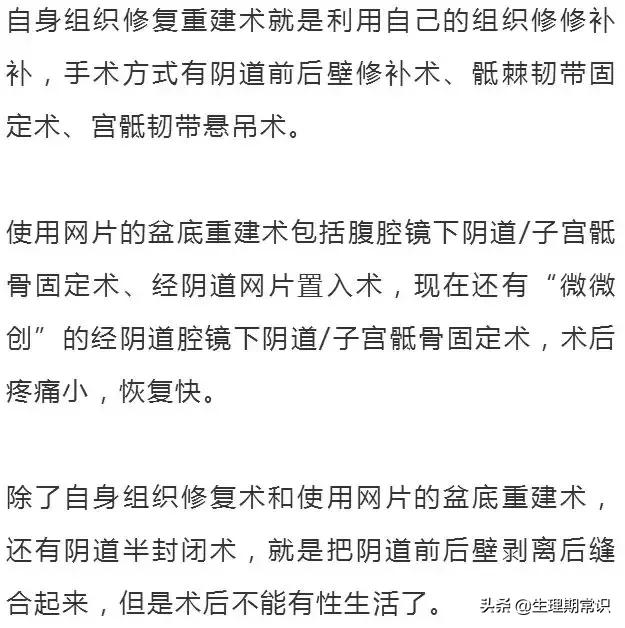 阴道里脱出块“肉”！