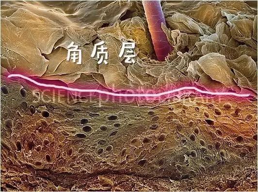 这4款人人用过的去屑洗发水能去屑控油吗？飘柔/海飞丝/潘婷/清扬