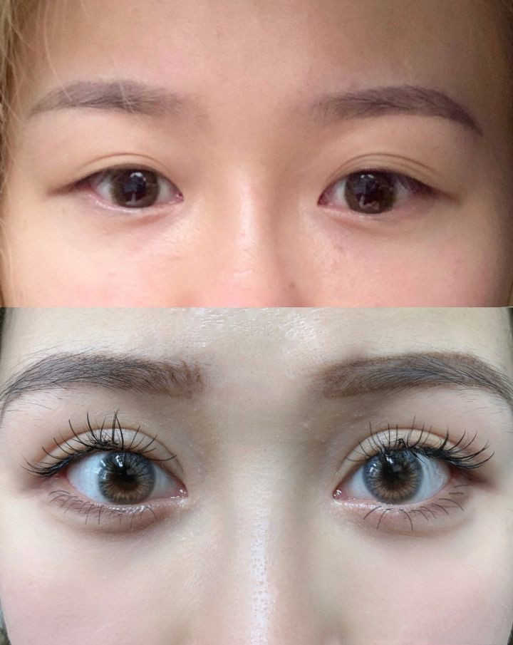 看完再决定要不要入坑,怎样判断需不需要开外眼角