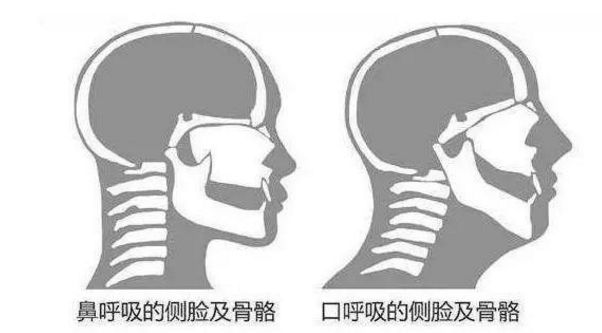 舍友打呼让他听啥歌,舍友打呼怎么解决