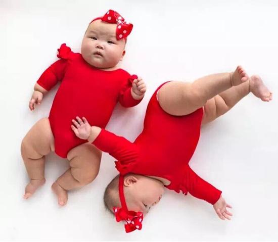 最美胎记小女孩,最美胎记女孩子