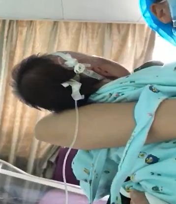 婴儿腰椎穿刺两次没成功,宝宝腰穿刺失败