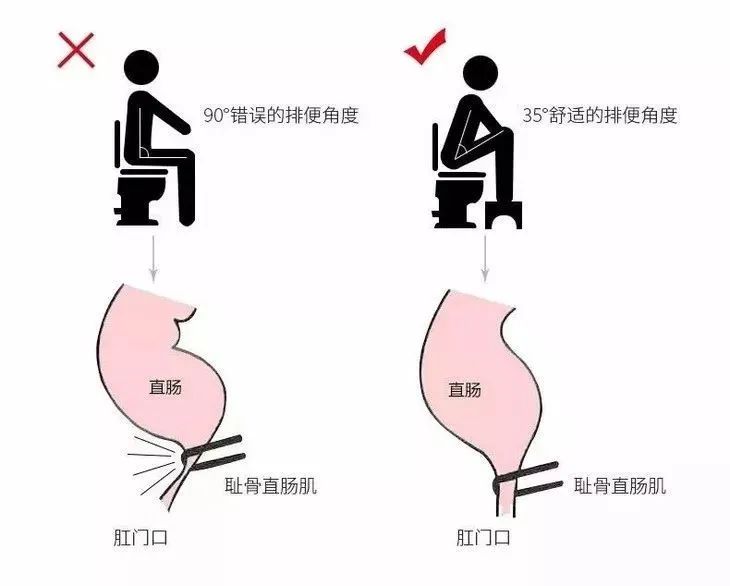 你便秘,你的便秘是怎么来的