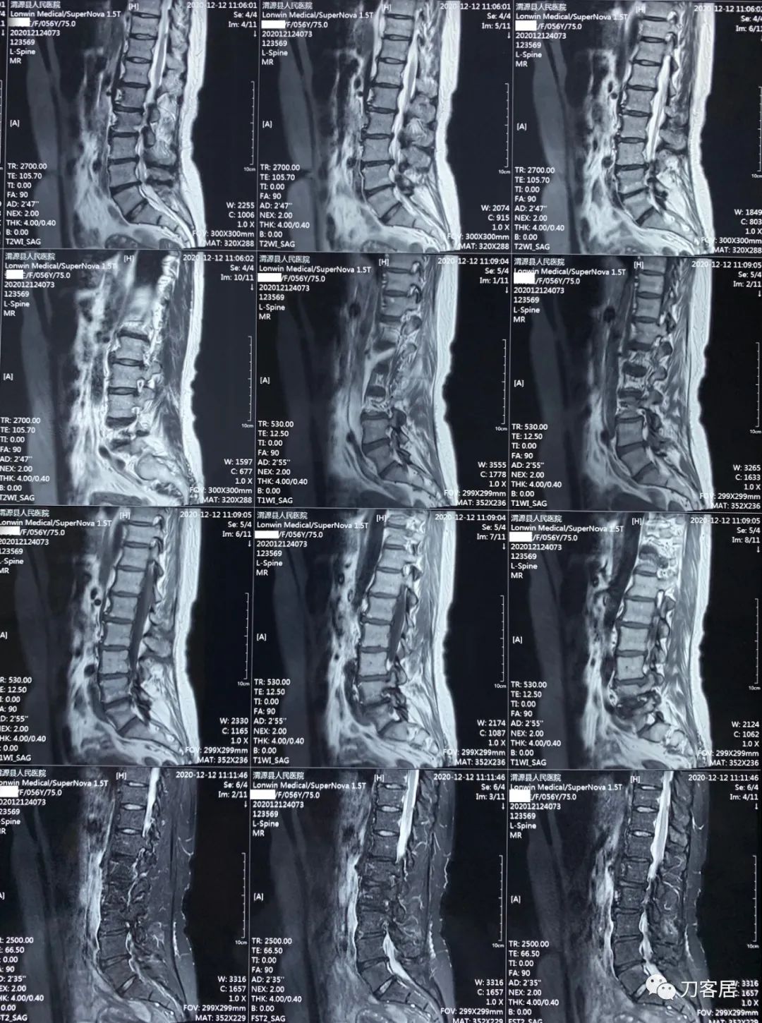 我的门诊病历,我的门诊