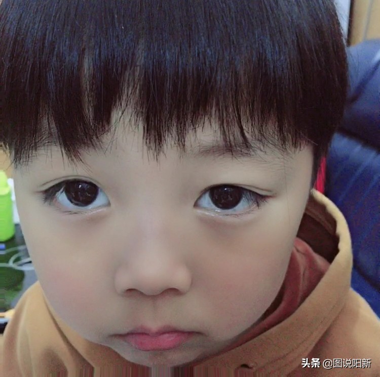 2岁男童确诊新冠,两名病情好转的心冠患者