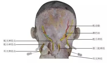 颈源性头痛中医治疗,颈源性头痛中药处方
