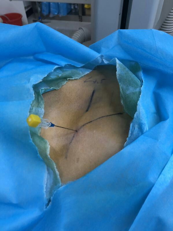 辉县骨科最好的医院是哪家,辉县市骨科医院