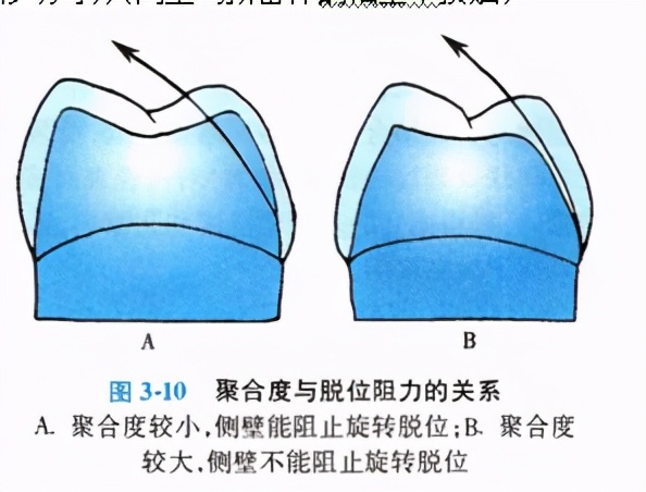 牙齿缺损修复去哪家牙科医院,牙科门牙缺损修复照片