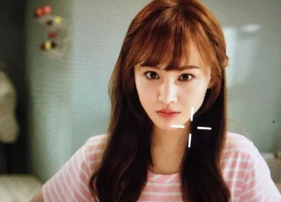 发际线秃有没有好的方法,发际线秃了一块怎么弄齐刘海