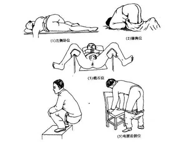 灌肠的体会,灌肠操作心得体会