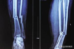 x光ct和核磁共振分别多少钱,ct与x光与核磁共振的区别是什么