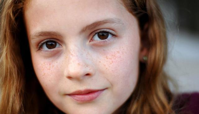 雀斑激光祛斑需要几次才能祛干净,有什么办法可以祛雀斑不反弹