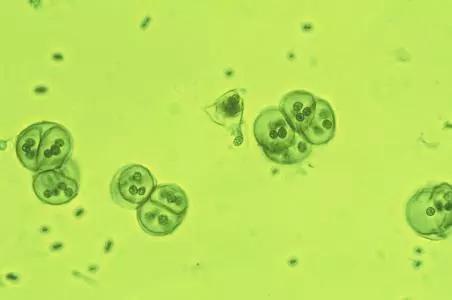 水产养殖蓝藻过多知识,水产养殖中蓝藻处理方法