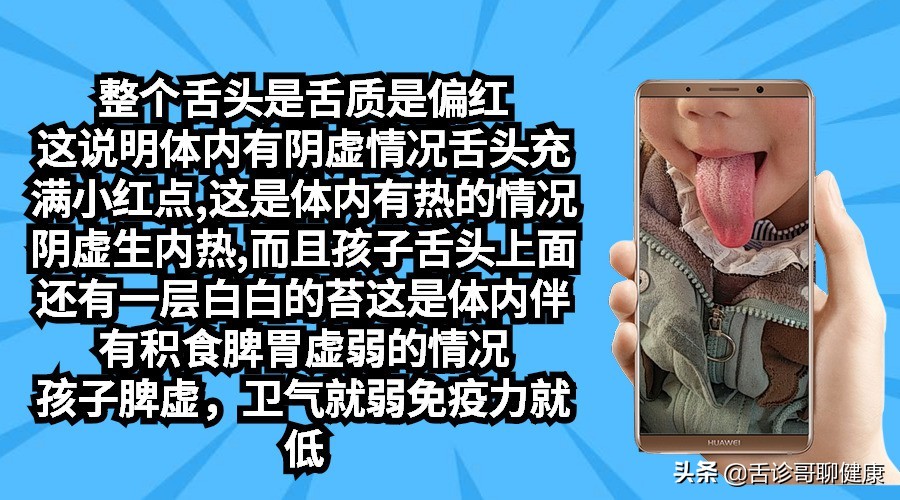 舌诊哥聊健康调脾胃,舌诊哥聊健康