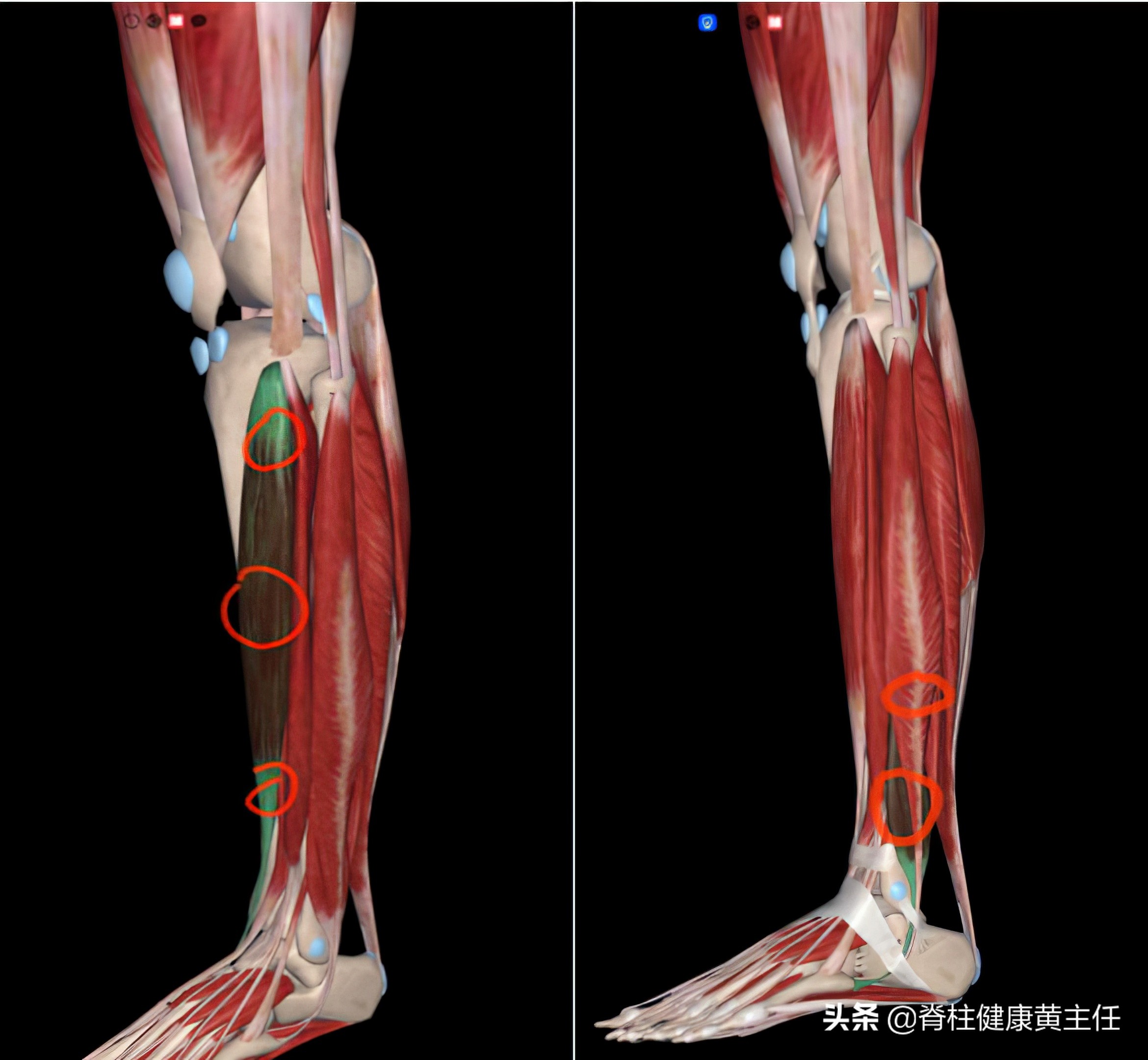 踝关节扭伤治疗手法,踝关节扭伤康复训练手法