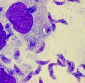 三十而已大结局钟晓芹怀孕,钟晓芹再次怀孕大结局