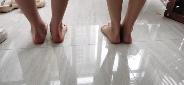 预防足外翻的绑带,儿童买鞋预防足外翻