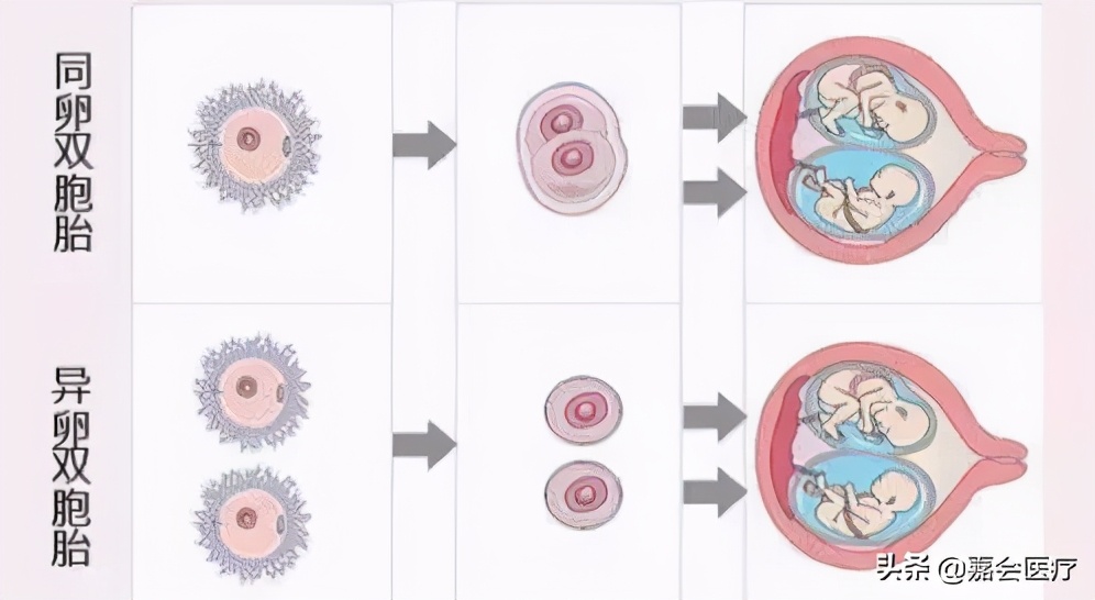 护理双胞胎新生儿应注意哪些,照顾双胞胎婴儿需要注意什么