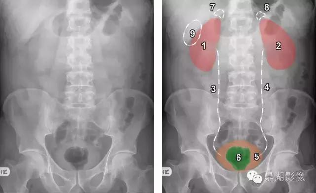 X线高清图谱|精致腹部解剖